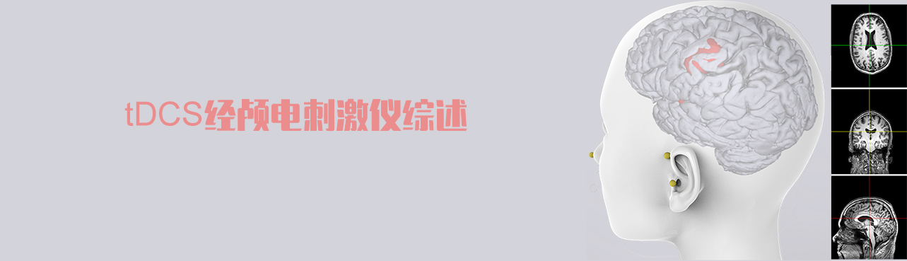 经颅电刺激仪怎么用经颅直流电刺激仪_https://www.jmylbn.com_新闻资讯_第1张