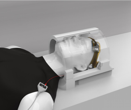 经颅电刺激仪怎么用经颅直流电刺激仪_https://www.jmylbn.com_新闻资讯_第6张