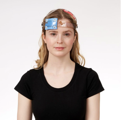 经颅电刺激仪怎么用经颅直流电刺激仪_https://www.jmylbn.com_新闻资讯_第5张