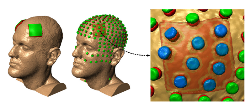 经颅电刺激仪怎么用经颅直流电刺激仪_https://www.jmylbn.com_新闻资讯_第4张